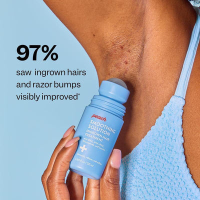 Smoothing Solution for Ingrown Hair Treatment